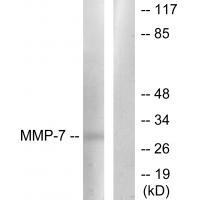 Rabbit Polyclonal Antibody to MMP-7