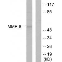 Rabbit Polyclonal Antibody to MMP-8