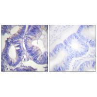 Rabbit Polyclonal Antibody to NCK2
