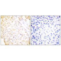 Rabbit Polyclonal Antibody to NKX3.1