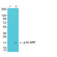 Rabbit Polyclonal Antibody to p14 ARF