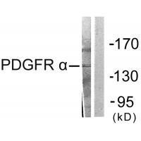 Rabbit Polyclonal Antibody to PDGFR α