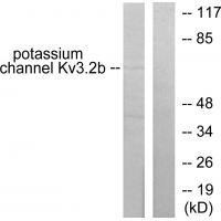 Rabbit Polyclonal Antibody to Potassium Channel Kv3.2b