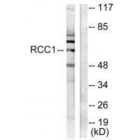 Rabbit Polyclonal Antibody to RCC1