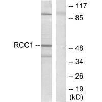 Rabbit Polyclonal Antibody to Retinoic Acid Receptor β