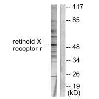 Rabbit Polyclonal Antibody to Retinoid X Receptor γ