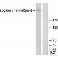 Rabbit Polyclonal Antibody to Sodium Channel-pan