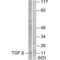 Rabbit Polyclonal Antibody to TGF β3