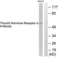 Rabbit Polyclonal Antibody to Thyroid Hormone Receptor α