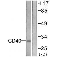 Rabbit Polyclonal Antibody to CD4