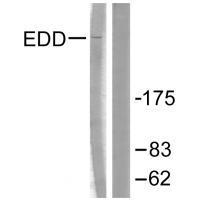 Rabbit Polyclonal Antibody to EDD