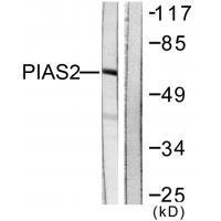 Rabbit Polyclonal Antibody to PIAS2