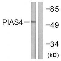 Rabbit Polyclonal Antibody to PIAS4