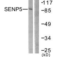 Rabbit Polyclonal Antibody to SENP5