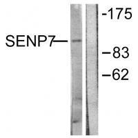 Rabbit Polyclonal Antibody to SENP7