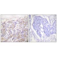 Rabbit Polyclonal Antibody to TNF Receptor-1