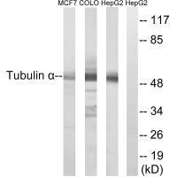 Rabbit Polyclonal Antibody to Tubulin α