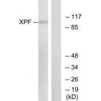 Rabbit Polyclonal Antibody to XPF