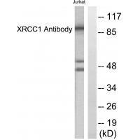 Rabbit Polyclonal Antibody to XRCC1