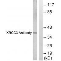 Rabbit Polyclonal Antibody to XRCC3
