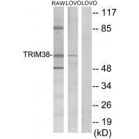 Rabbit Polyclonal Antibody to TRIM38