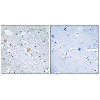 Rabbit Polyclonal Antibody to CTRO