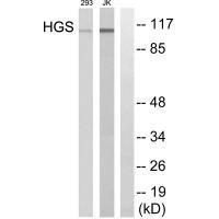 Rabbit Polyclonal Antibody to HGS