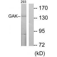 Rabbit Polyclonal Antibody to GAK