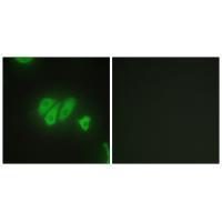 Rabbit Polyclonal Antibody to PDZD2