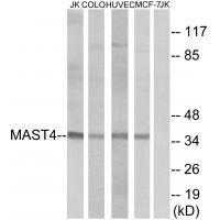 Rabbit Polyclonal Antibody to MAST4