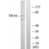 Rabbit Polyclonal Antibody to TRI18