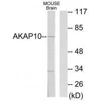 Rabbit Polyclonal Antibody to AKAP1