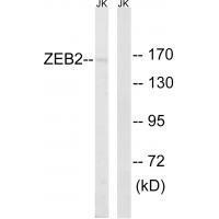 Rabbit Polyclonal Antibody to ZEB2