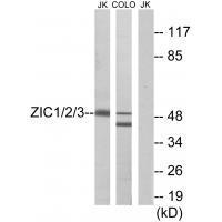 Rabbit Polyclonal Antibody to ZIC1/2/3