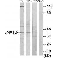 Rabbit Polyclonal Antibody to LMX1B