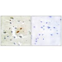 Rabbit Polyclonal Antibody to DNA Polymerase ζ