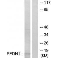 Rabbit Polyclonal Antibody to PFDN1