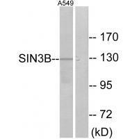 Rabbit Polyclonal Antibody to SIN3B