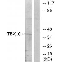 Rabbit Polyclonal Antibody to TBX1