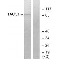 Rabbit Polyclonal Antibody to TACC1