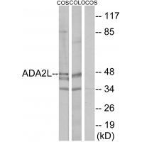 Rabbit Polyclonal Antibody to ADA2L
