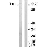 Rabbit Polyclonal Antibody to FIR