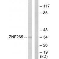 Rabbit Polyclonal Antibody to ZNF265