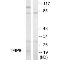 Rabbit Polyclonal Antibody to TFIP8