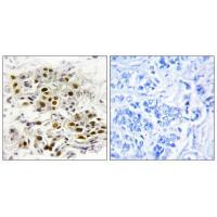 Rabbit Polyclonal Antibody to MAP3K6