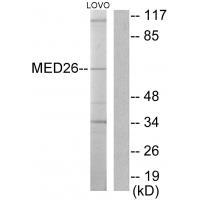 Rabbit Polyclonal Antibody to MED26