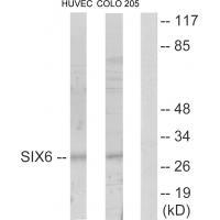 Rabbit Polyclonal Antibody to SIX6