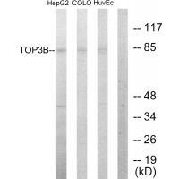 Rabbit Polyclonal Antibody to TOP3B