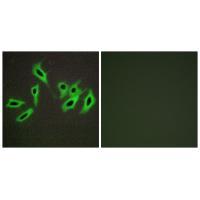 Rabbit Polyclonal Antibody to Heparin Cofactor II