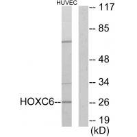 Rabbit Polyclonal Antibody to HOXC6